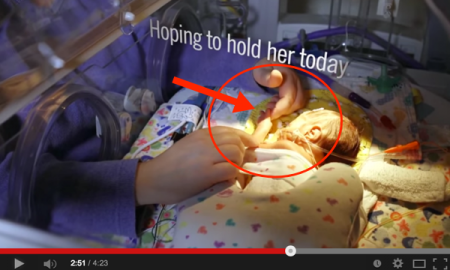 Cuma Pegang Jari, Ibu Ini Berharap Dapat Peluk Bayi Pra-Matang Sendiri. Kalaulah Kita Faham Perasaan Dia & 25 Orang Lain Dalam Video Ini.