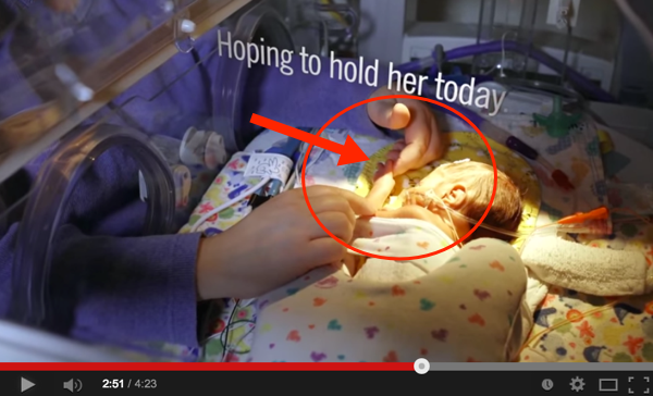 Cuma Pegang Jari, Ibu Ini Berharap Dapat Peluk Bayi Pra-Matang Sendiri. Kalaulah Kita Faham Perasaan Dia & 25 Orang Lain Dalam Video Ini.