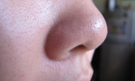 5 Cara Menghilangkan Bintik Hitam Di Muka & Hidung Secara Semulajadi
