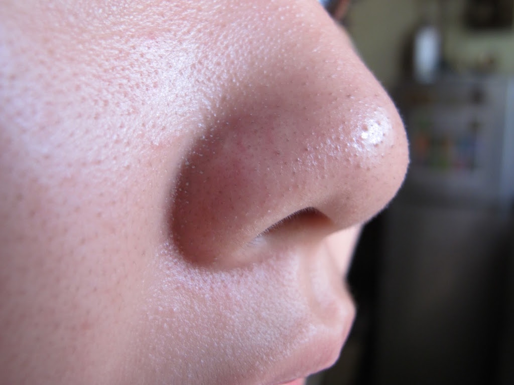5 Cara Menghilangkan Bintik Hitam Di Muka & Hidung Secara Semulajadi