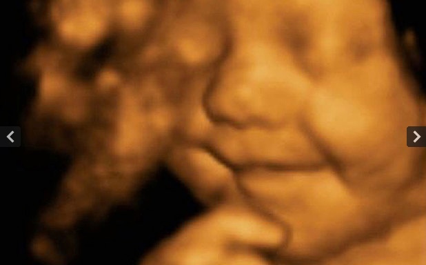 bayi-tersenyum-ultrasound-4d-scan-2