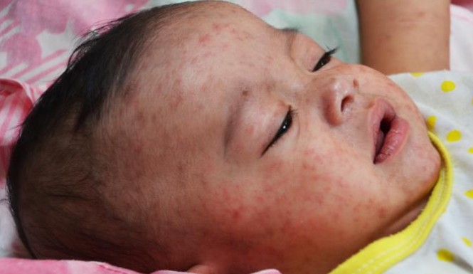 Petua hilangkan demam bayi