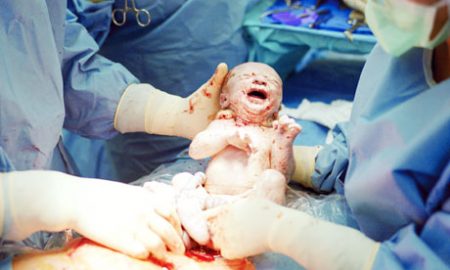 Proses kelahiran bayi