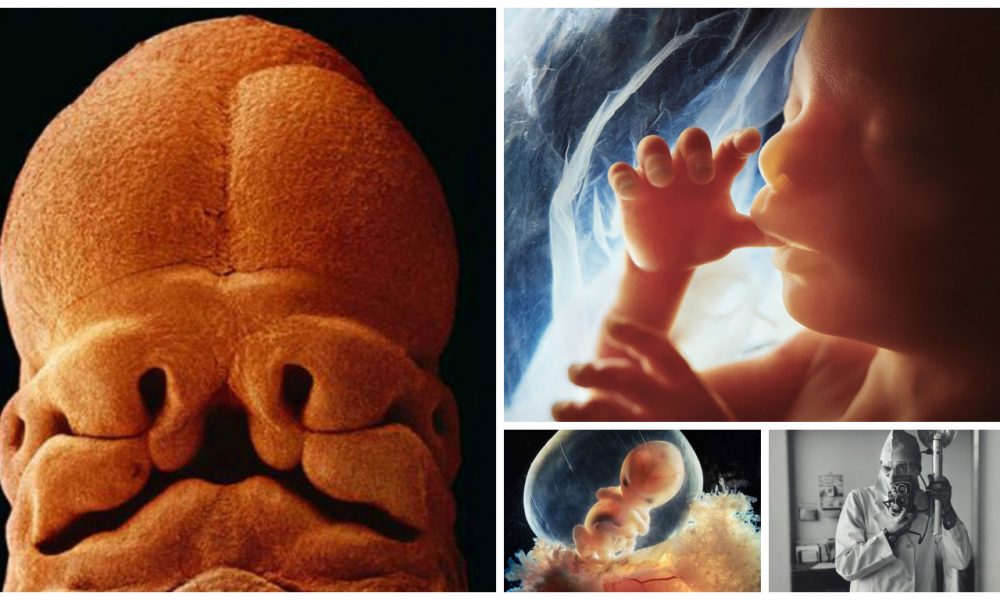 25 Gambar  Pembentukan Bayi  Dalam  Kandungan  Setelah 12 