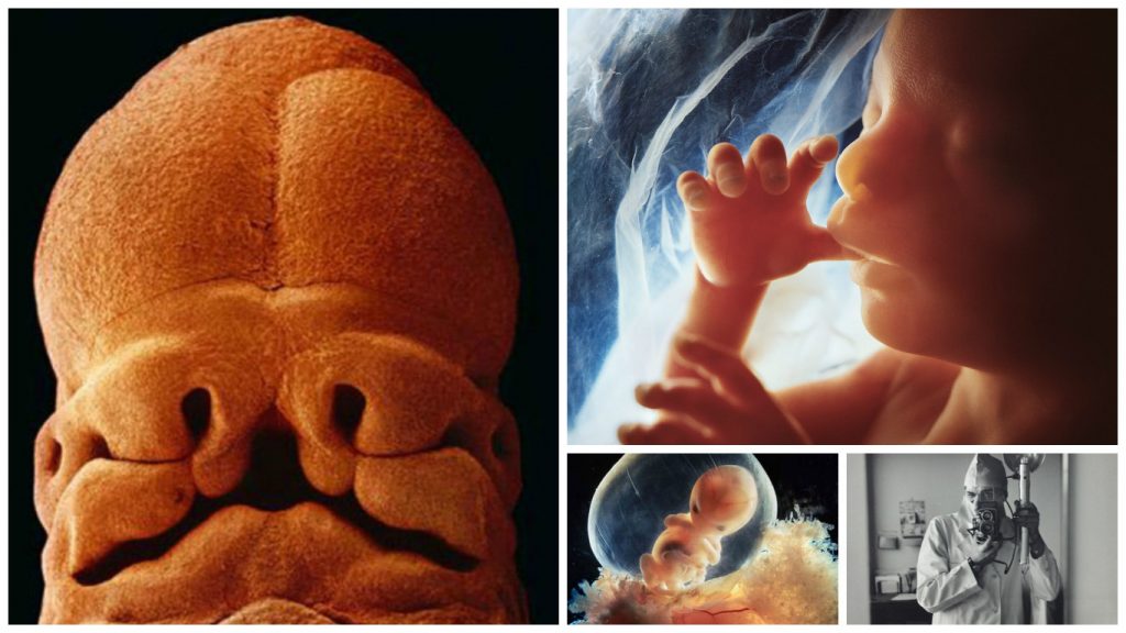25 Gambar  Pembentukan Bayi Dalam Kandungan  Setelah 12 