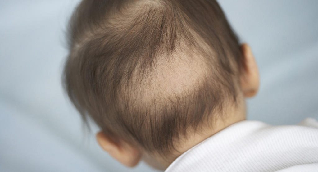 7 Cara Melebatkan Rambut Bayi Dengan Cepat Elak Cukur Bantal