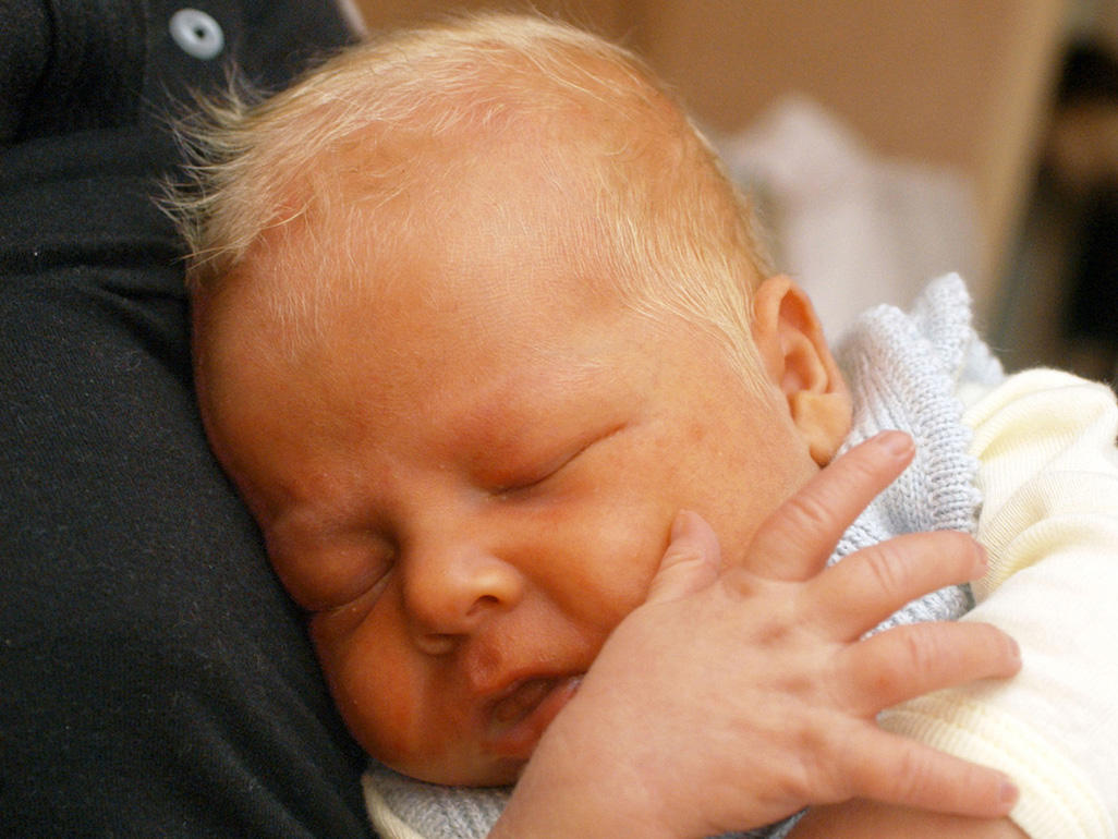 Demam Kuning Dalam Kalangan Bayi, Ini Petua Yang Anda 
