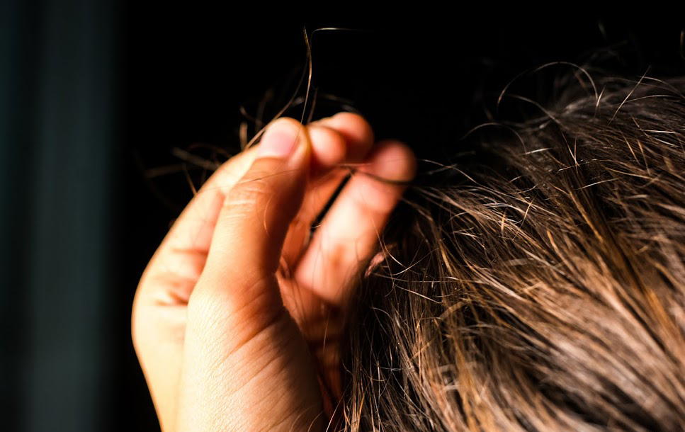 tabiat suka tarik rambut trichotillomania