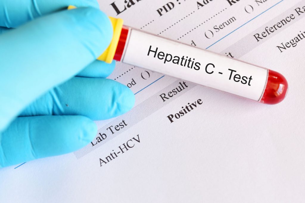Ujian Saringan Hepatitis C Percuma Di Klinik Kesihatan 15 