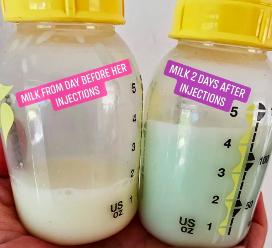 "Kenapa Susu Badan Saya Warna Hijau?"- Pakar Nutrisi Jelas 